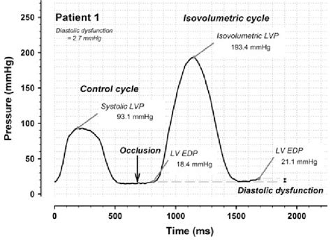 lv pressure tracing|left ventricular pressure measurement.